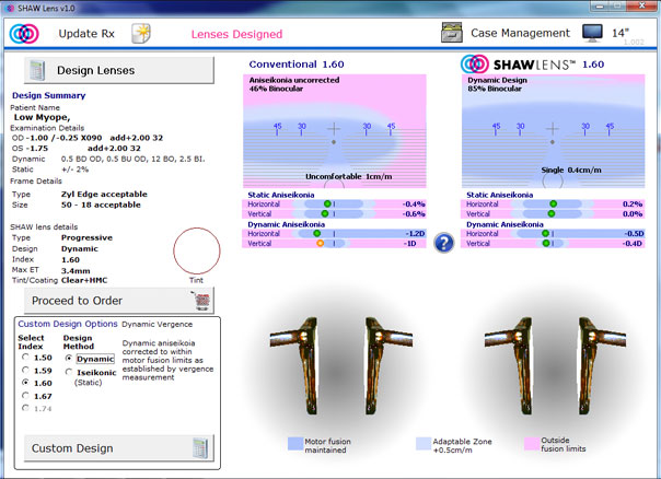 Onscreen template for face form angles Onscreen template for face form angles