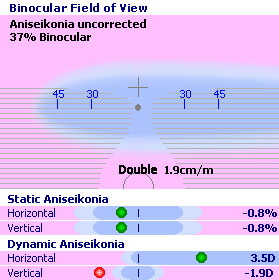 Prismatic correction conventional