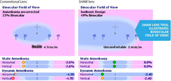 Case: 4 year old amblyope